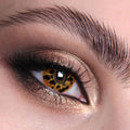 Infected contact lenses